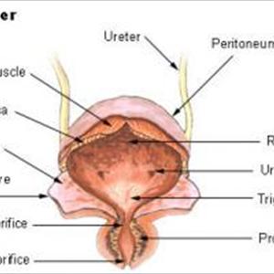 Bladder Inflammation Advice - How To Get Rid Of Urinary Tract Infection - Treat A Uti Naturally